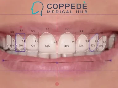 Risultato finale di Digital Smile Design a Roma: sorriso armonico e naturale progettato in 3D dai dottori Brauner.